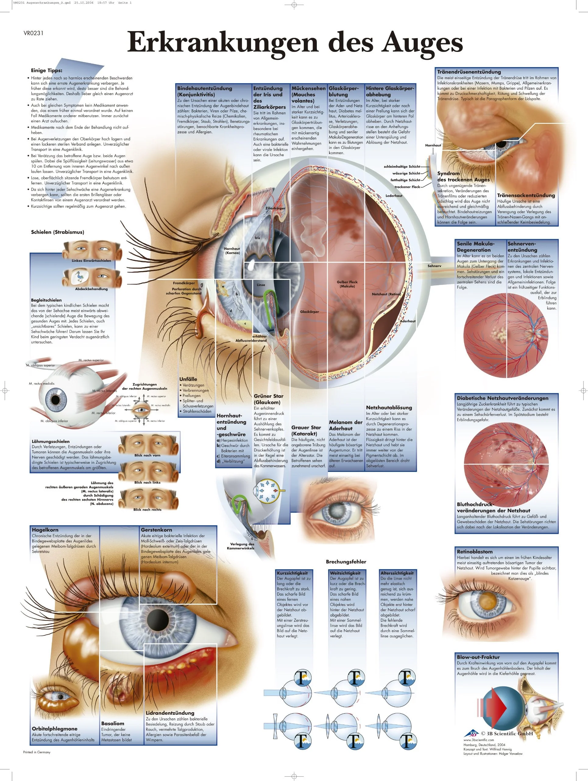 3B Scientific Clay Trafel – Diseases of the Eye, VR0231UU Paper