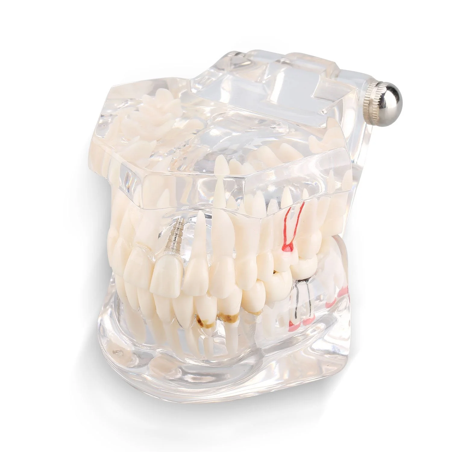 Model of Dentist Training, Dental Implant Disease Teaching Study Analysis Adult Typodont Demonstration Teeth Model New