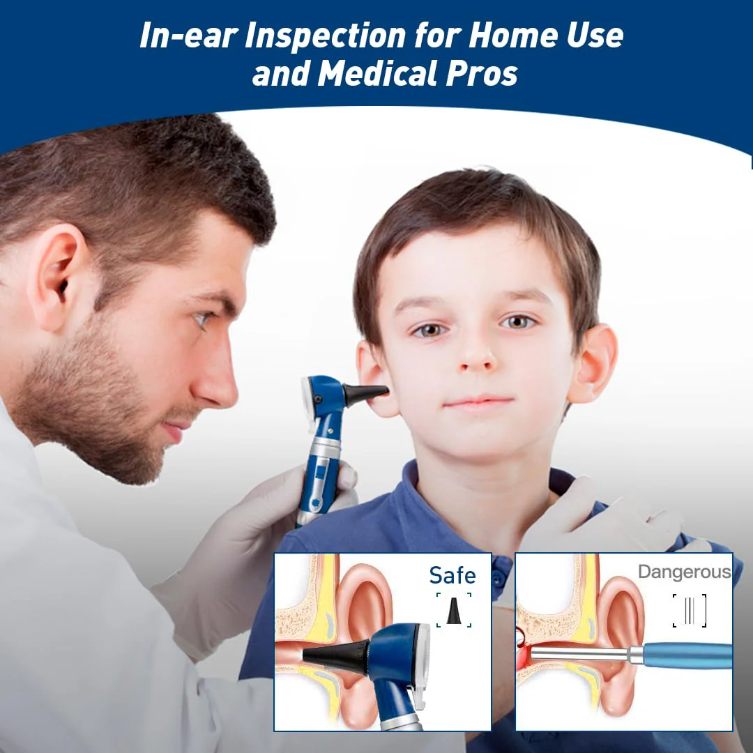 Scian Otoscope Ear Scope with Light, Pocket Fibre Optic Otoscopes with Hard Plastic Case for Doctors, Nurses, Children, Dogs, Home Use (New Blue) New blue - Image 2