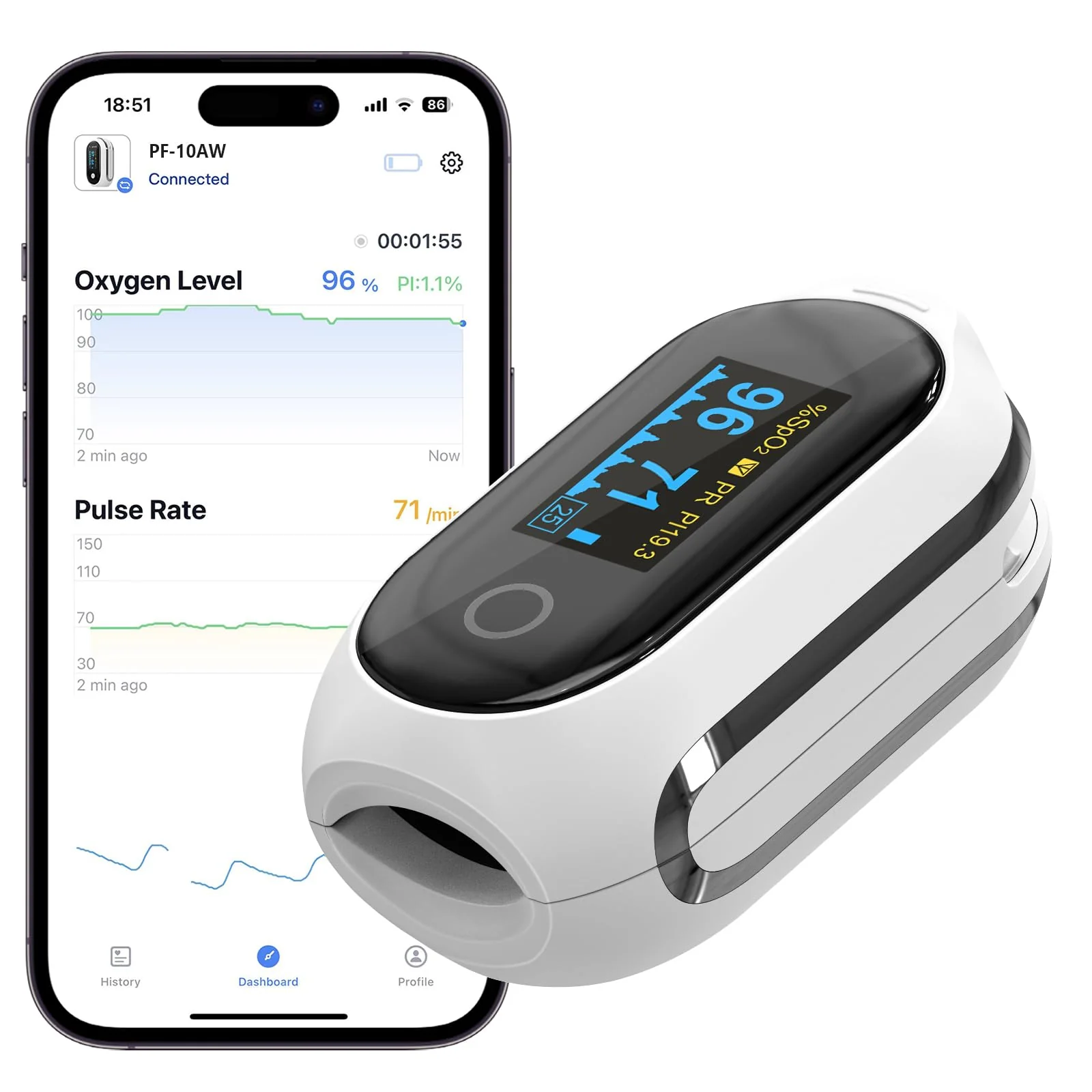 Vibeat Bluetooth Pulse Oximeter with 12 Offline Data, Rechargeable Oxygen Saturation Meter Finger, Continuous Monitoring, Pulse Oximeter, Finger Oximeter, Convenient Heart Rate Monitor with App